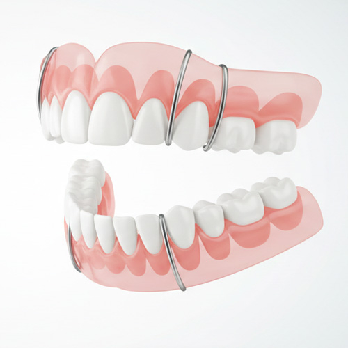 Протезирование