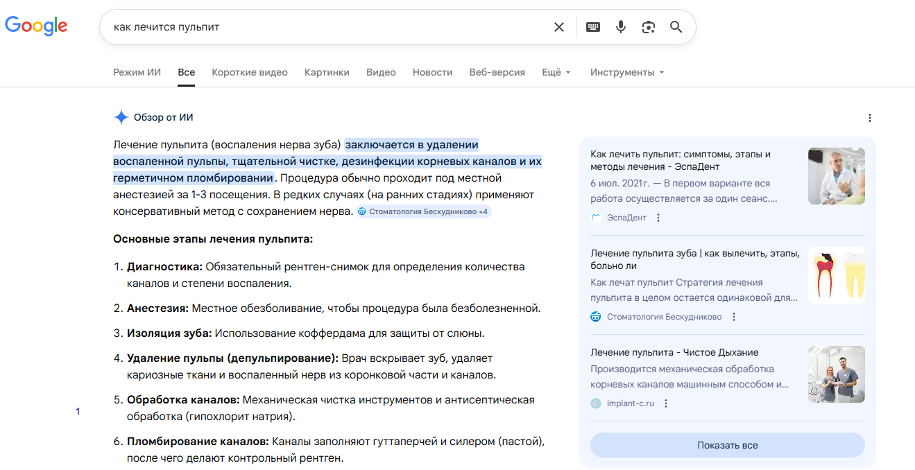 Как выглядит ответ в ПС Google по запросу “Как лечится пульпит” Как выглядит ответ в ПС Google по запросу “Как лечится пульпит”